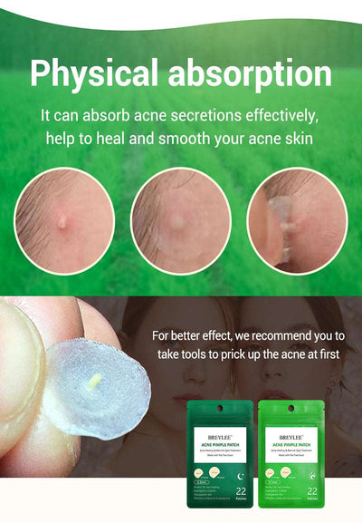 Acne Pimple Patch Stickers