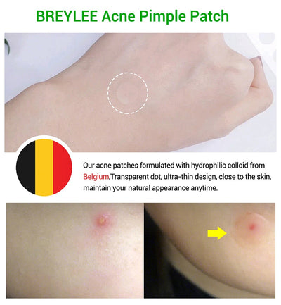 Acne Pimple Patch Stickers 6